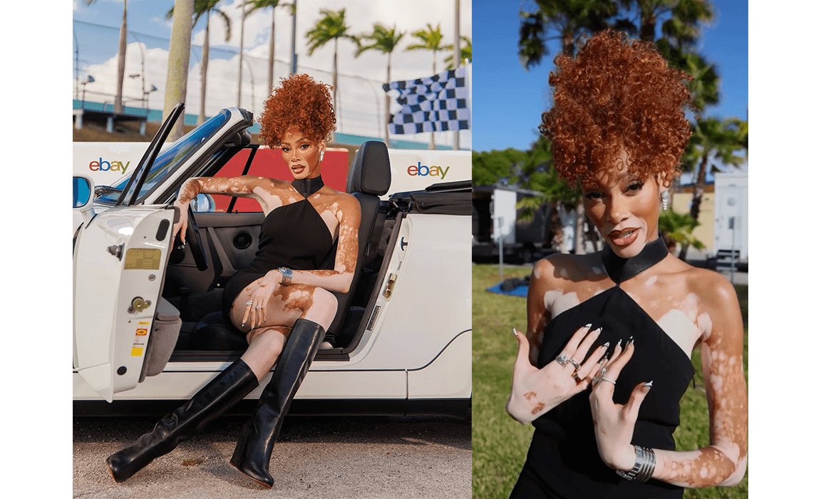 Winnie Harlow - Christina Caruso